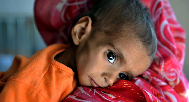 Disturbing Facts about Malnutrition in India